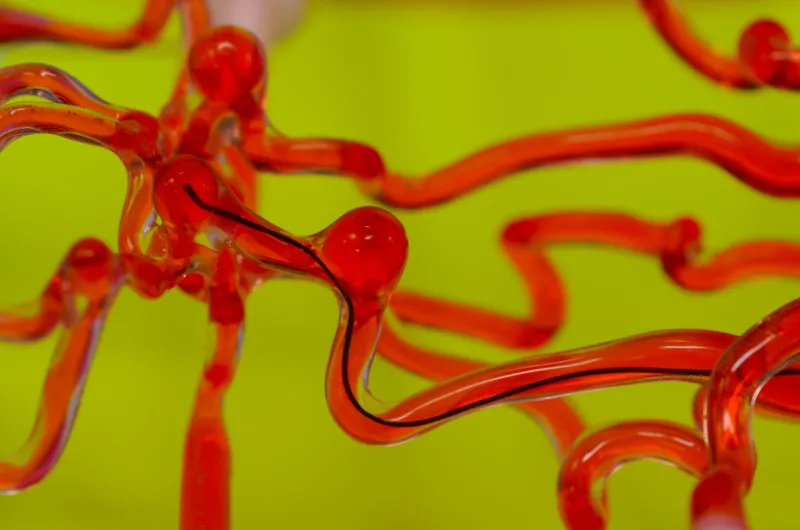 Demonstration of ferromagnetic soft continuum navigating a 3D cerebrovascular phantom network.